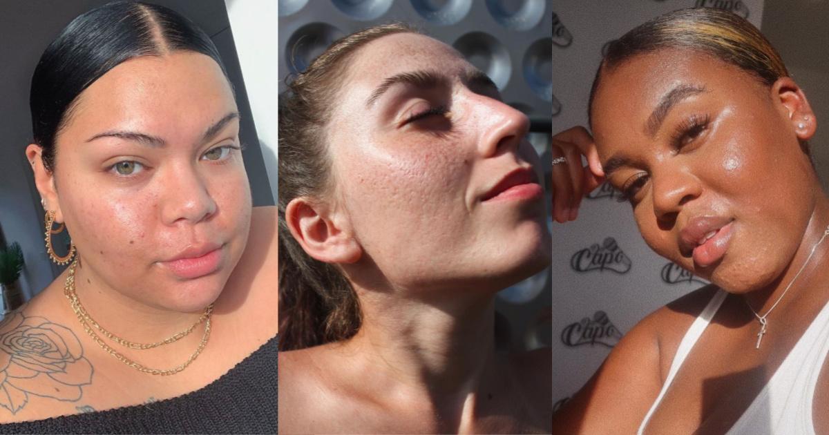 From acne to eczema, follow these 24 skinfluencers to fill your feed with ‘real’ skin.